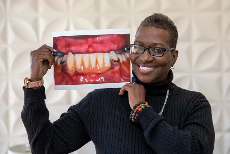 Smiling dental implant patient holding her before photo