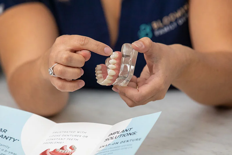 Dental implant model